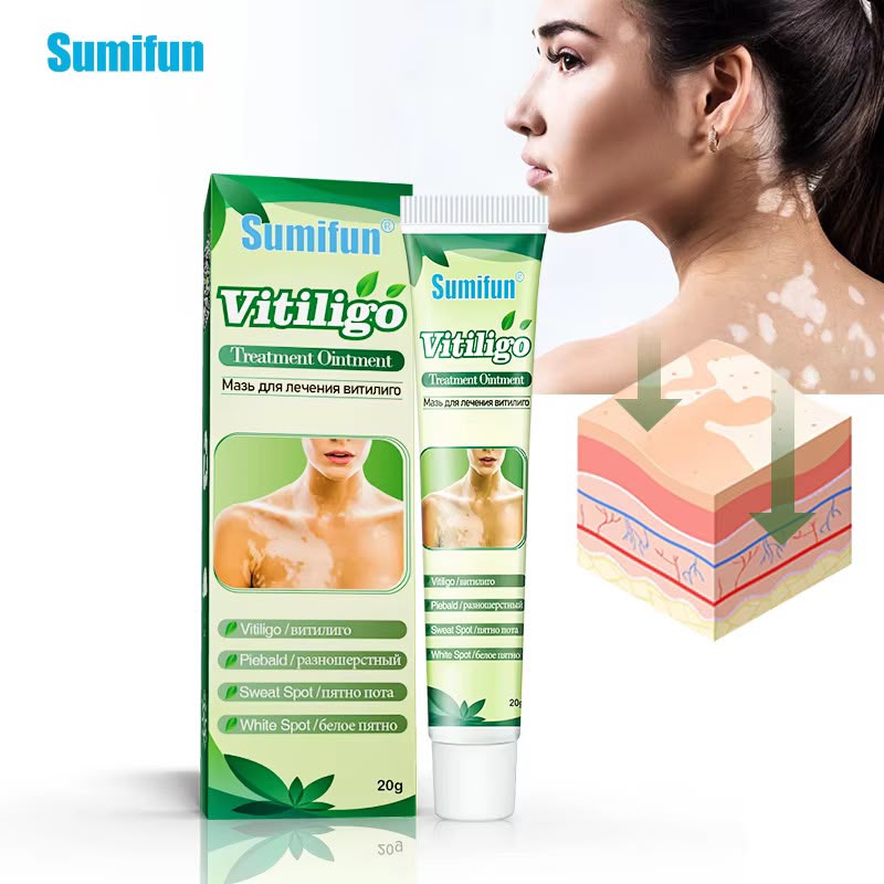 Sumifun Vitiligo Cream